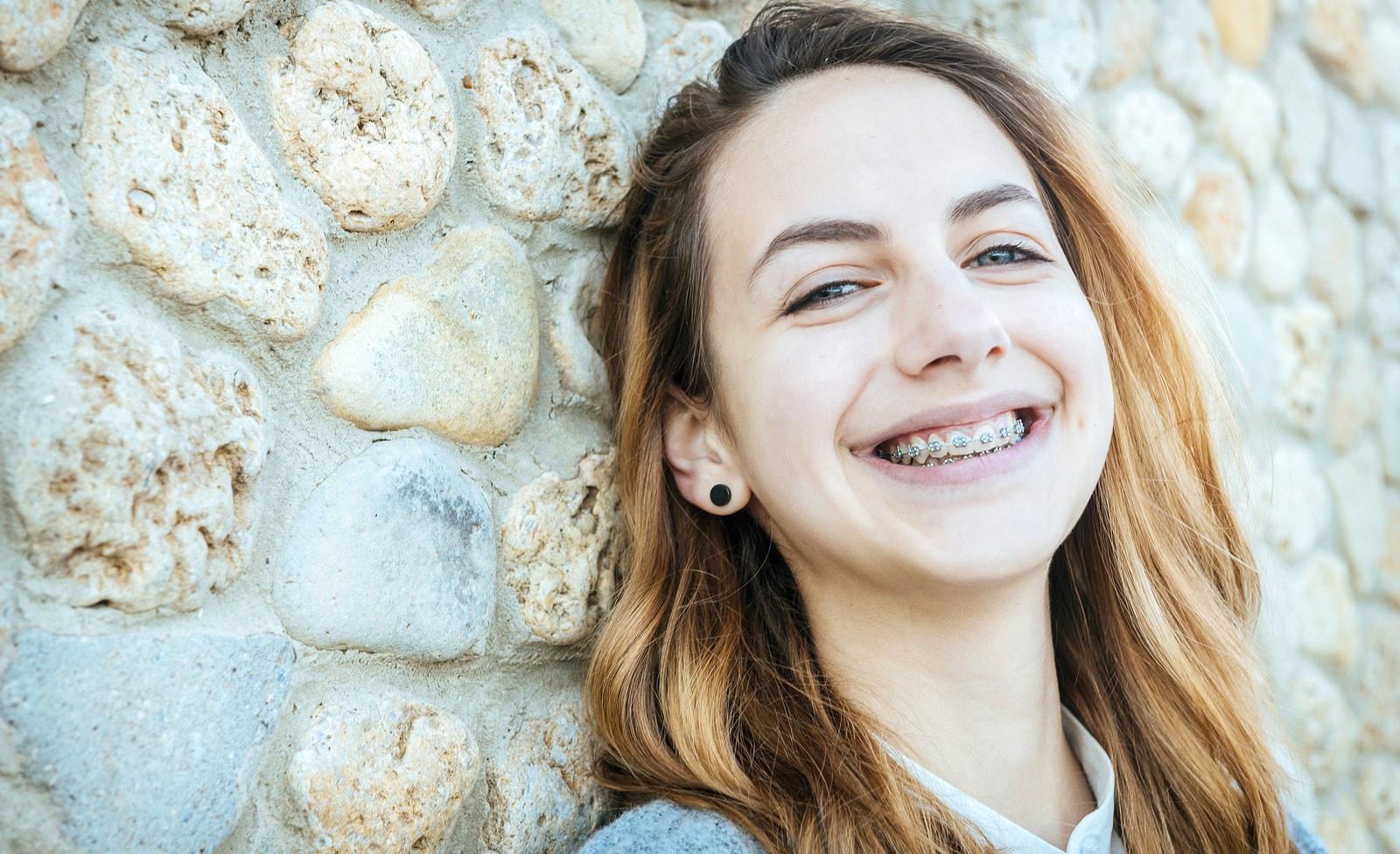 Life With Braces in Tucson - Smile Big