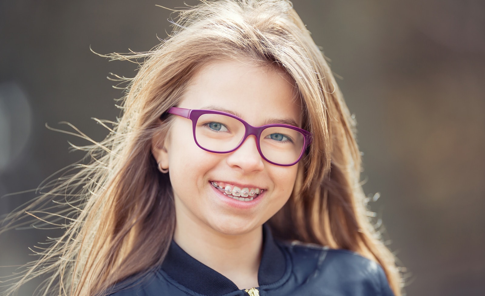 Cost of Braces - Smile Big