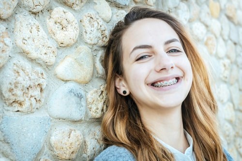 Life with Braces